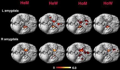 Mozak homoseksualne osobe nalikuje mozgu heteroseksualne osobe suprotnog pola